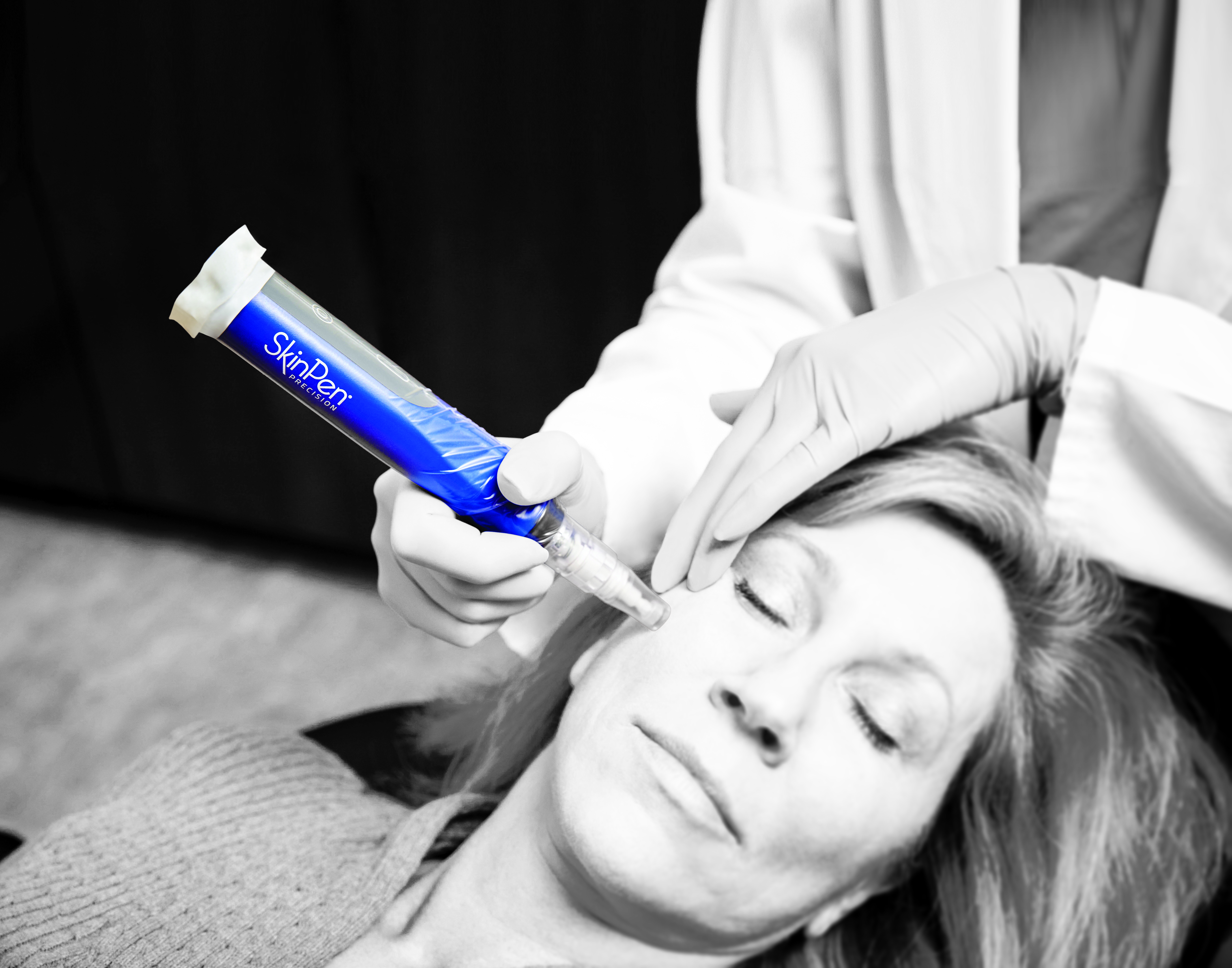 SkinPen Needling
